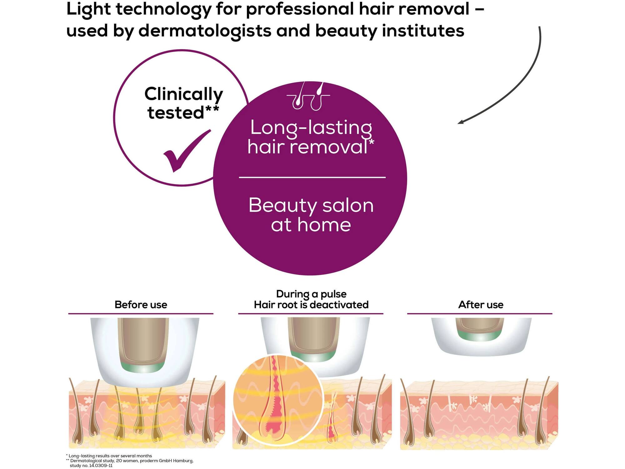 Beurer IPL Pure Skin Pro 5500